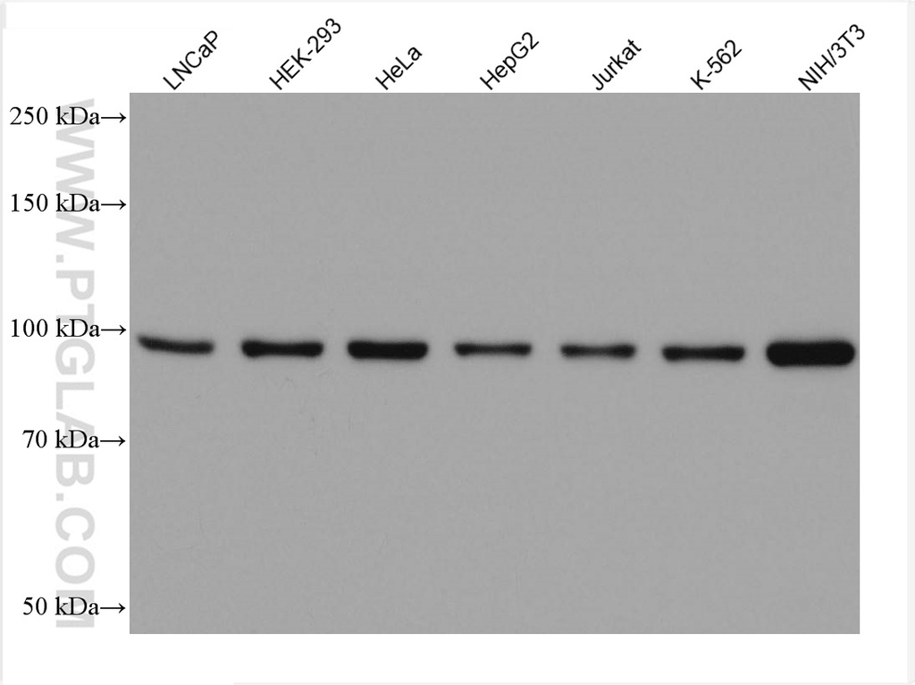 FER Monoclonal antibody