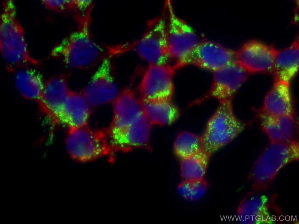 LRPPRC Monoclonal antibody
