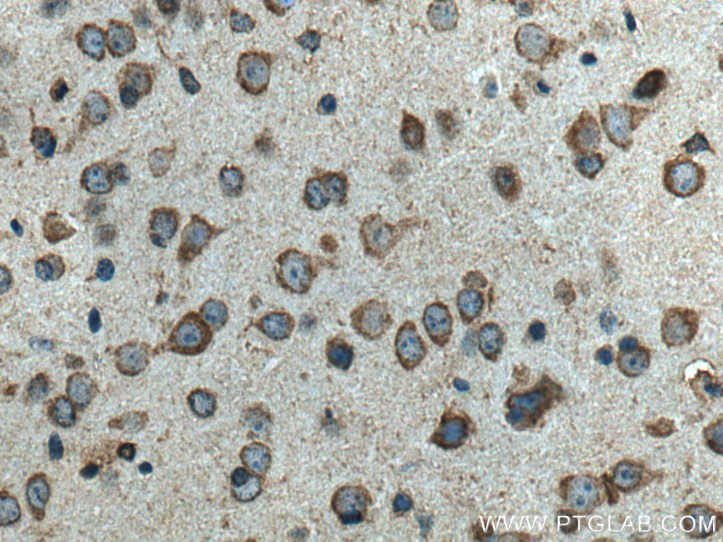 TRAP1 Monoclonal antibody