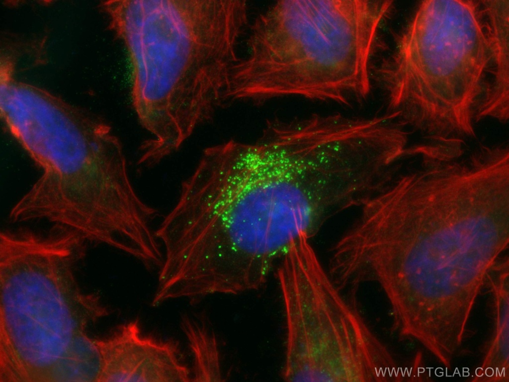 SNF8 Monoclonal antibody