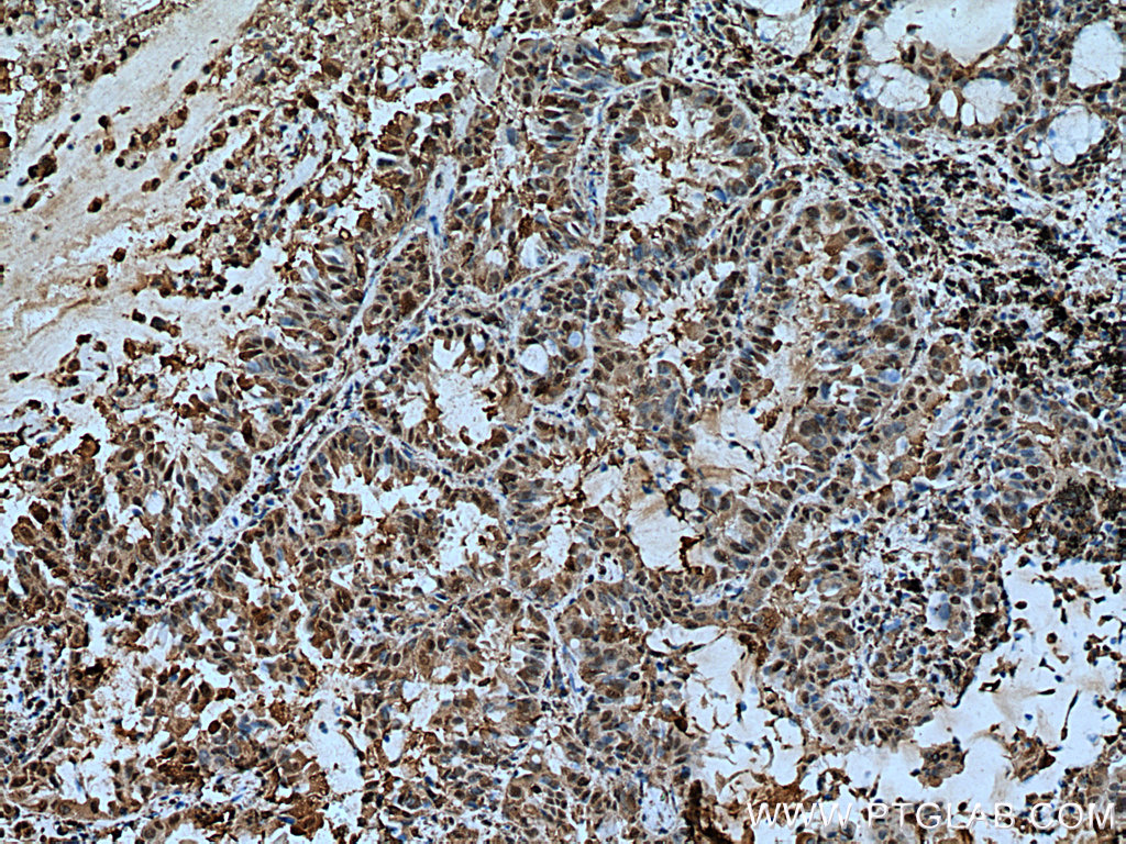 YWHAZ Monoclonal antibody