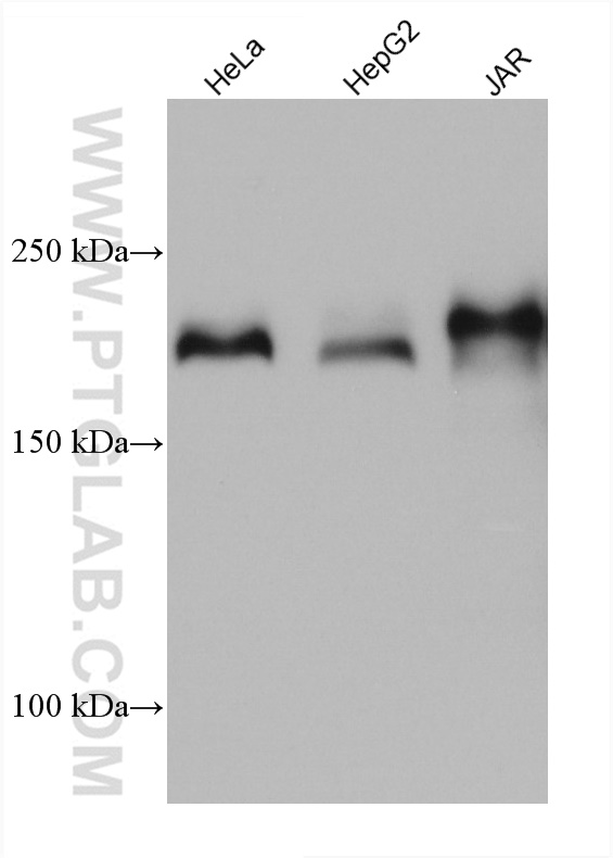 LAMC1 Monoclonal antibody