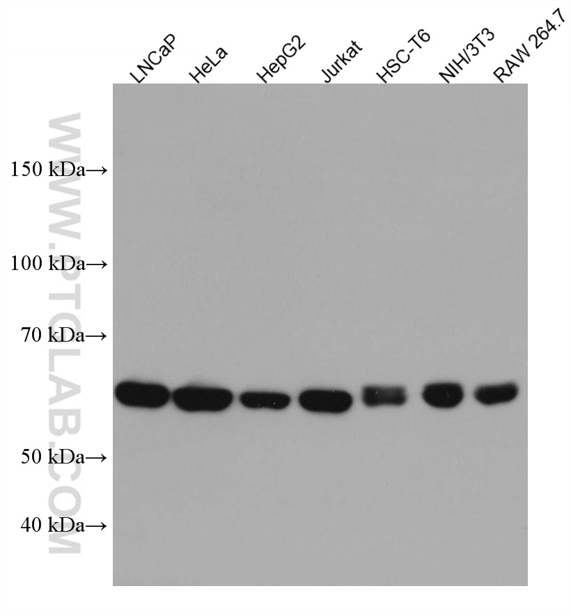 NARS Monoclonal antibody