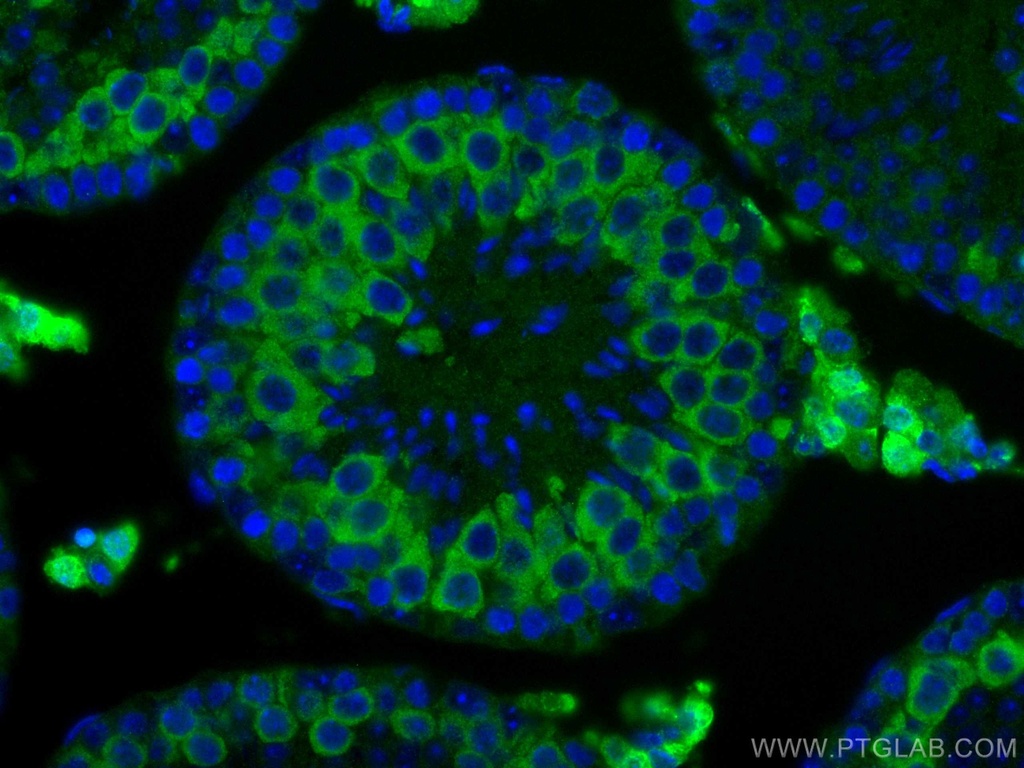 Cyclin B2 Monoclonal antibody