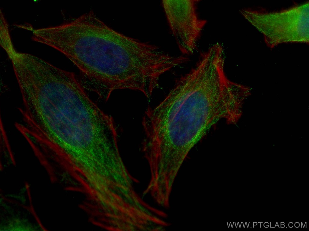 ATG4B Monoclonal antibody
