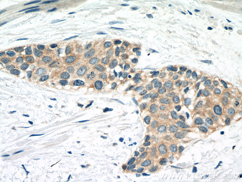 CAPN1 Monoclonal antibody