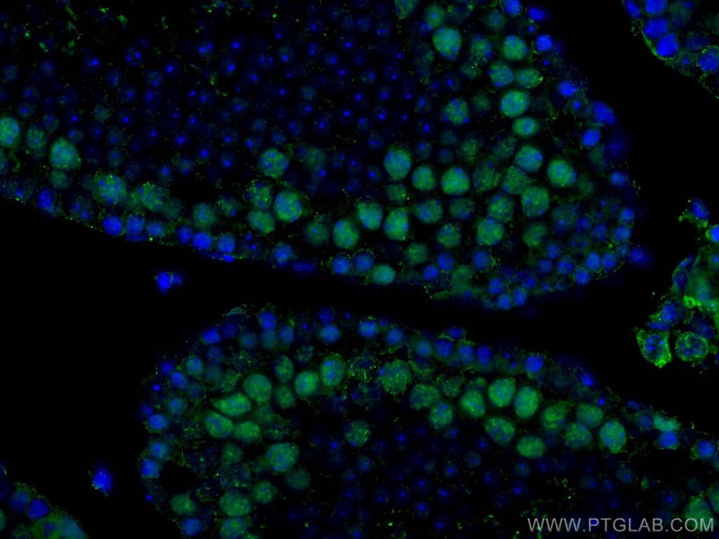 METTL3 Monoclonal antibody