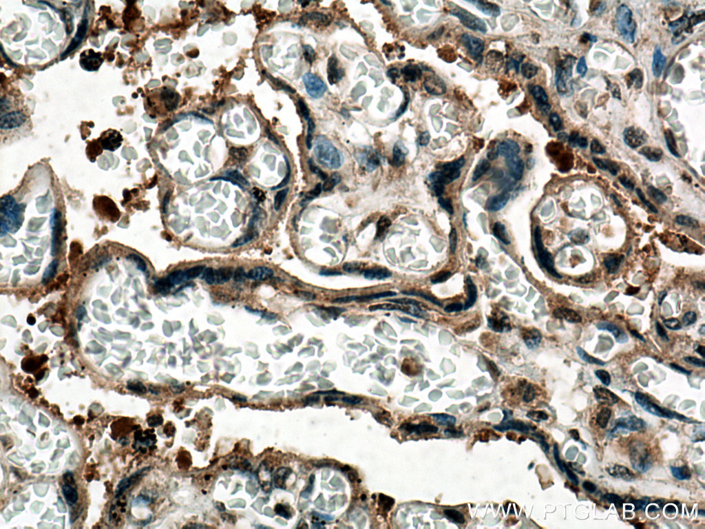 PTPN14 Monoclonal antibody