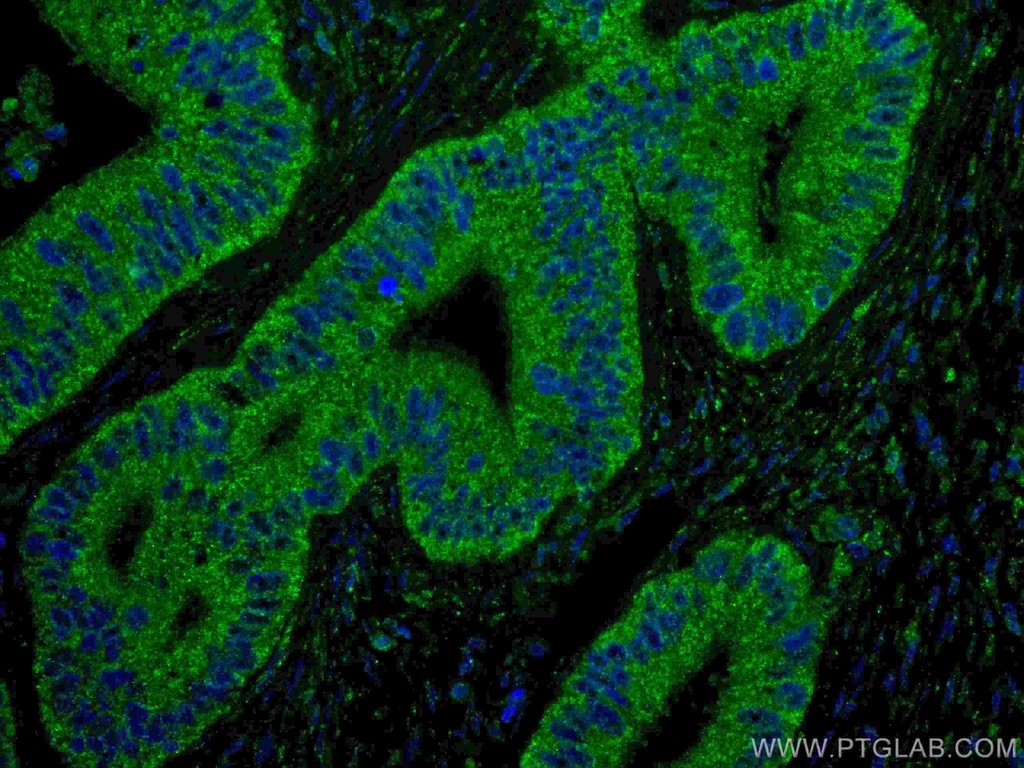 ING4 Monoclonal antibody