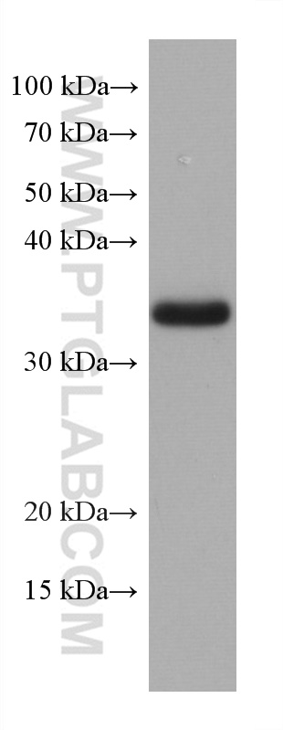 TMEM74 Monoclonal antibody