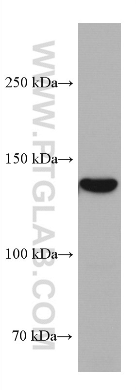 GUCY2C Monoclonal antibody