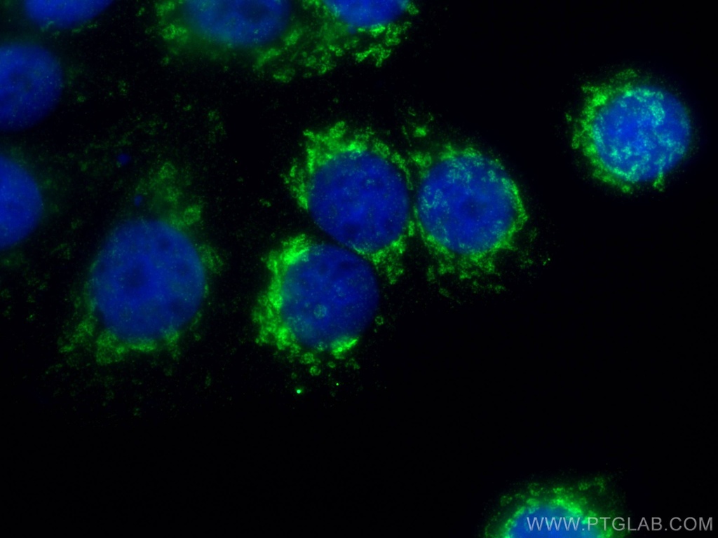 citrate synthase Monoclonal antibody