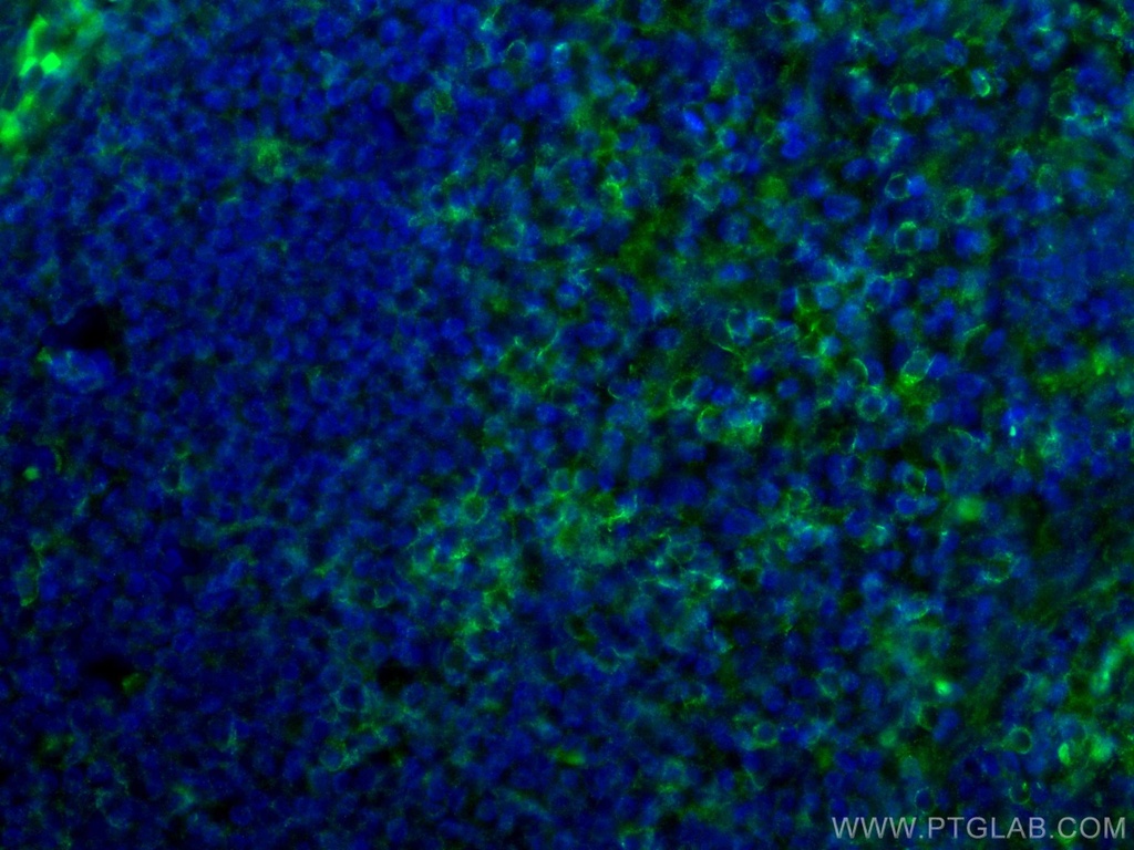 CD4 Monoclonal antibody
