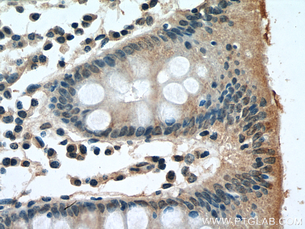TK1 Monoclonal antibody