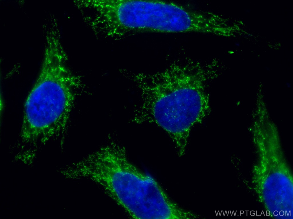 AIF Monoclonal antibody