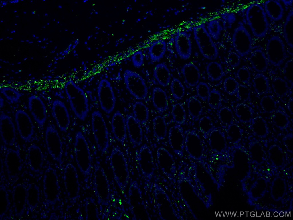 Desmin Monoclonal antibody