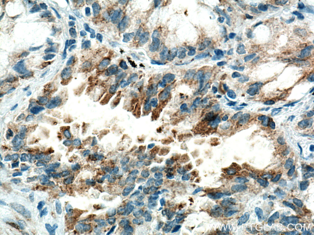 HK3 Monoclonal antibody