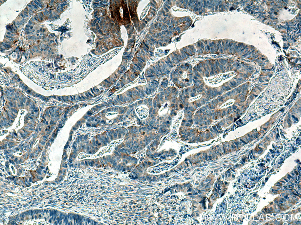 PKMYT1 Monoclonal antibody