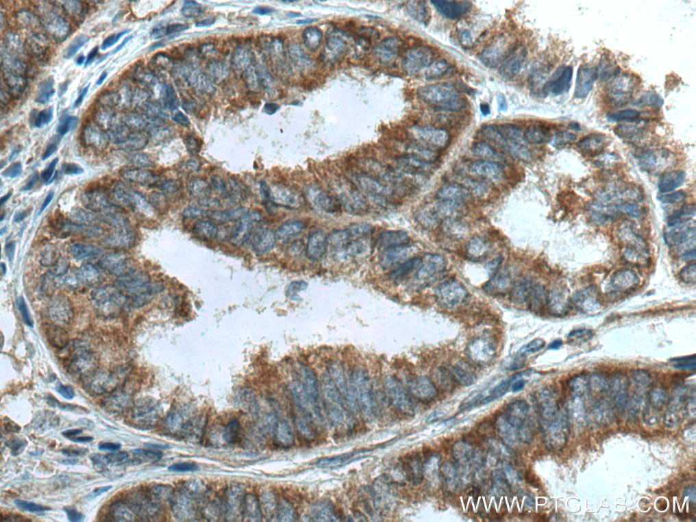 LARP1 Monoclonal antibody