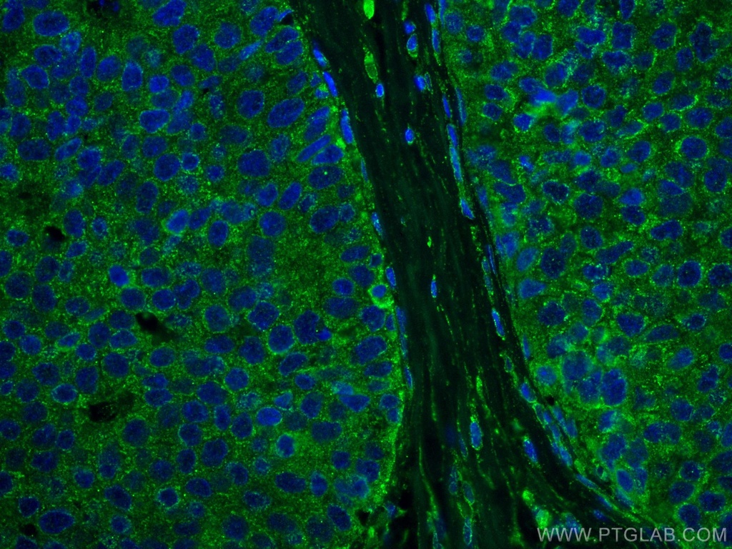 DAPK1 Monoclonal antibody