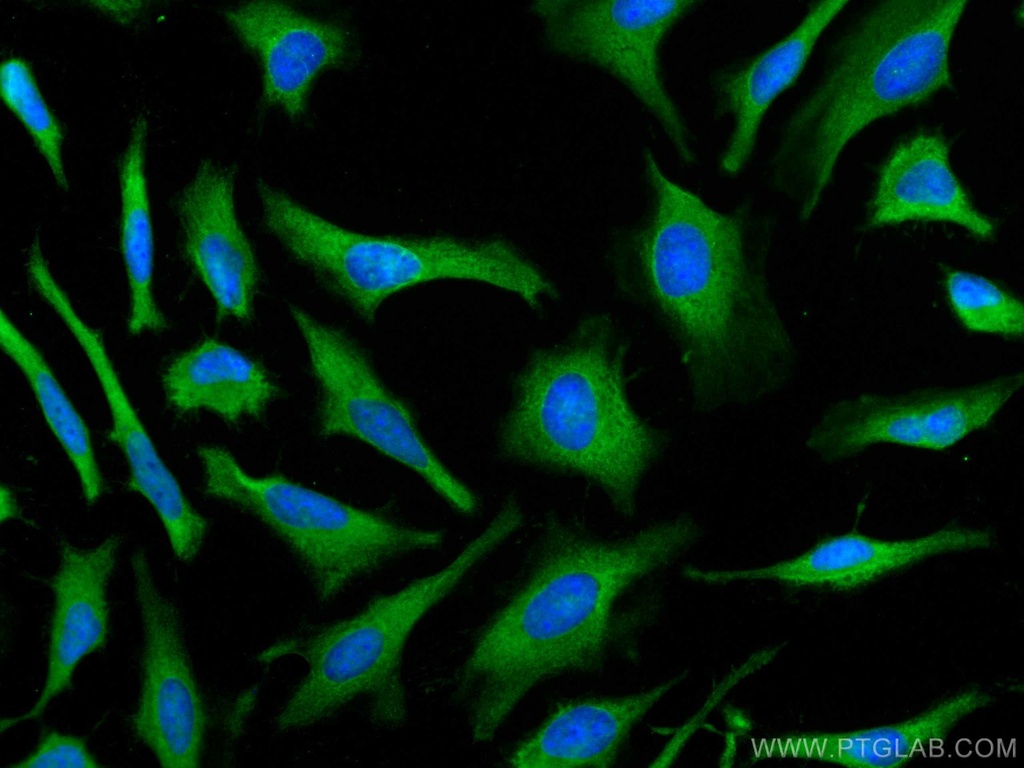 PSMA7 Monoclonal antibody