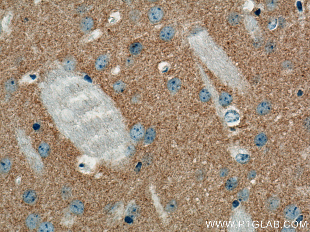 VAMP2 Monoclonal antibody