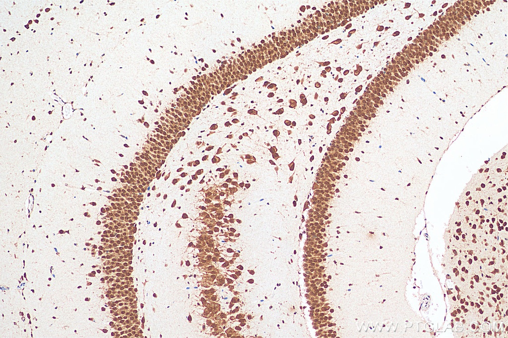 ELAVL4 Monoclonal antibody