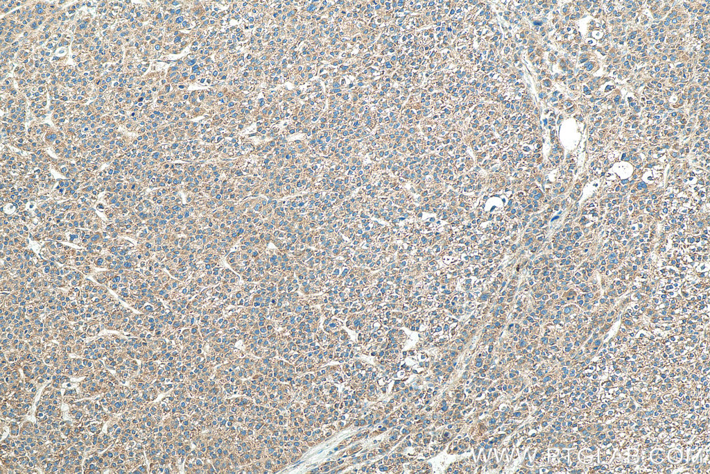 VAPA Monoclonal antibody