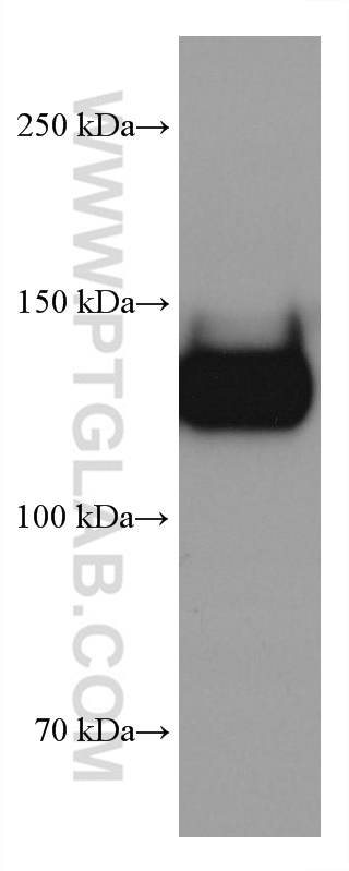 GP1BA Monoclonal antibody