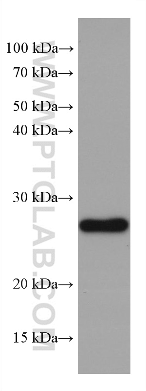 GSTM1 Monoclonal antibody