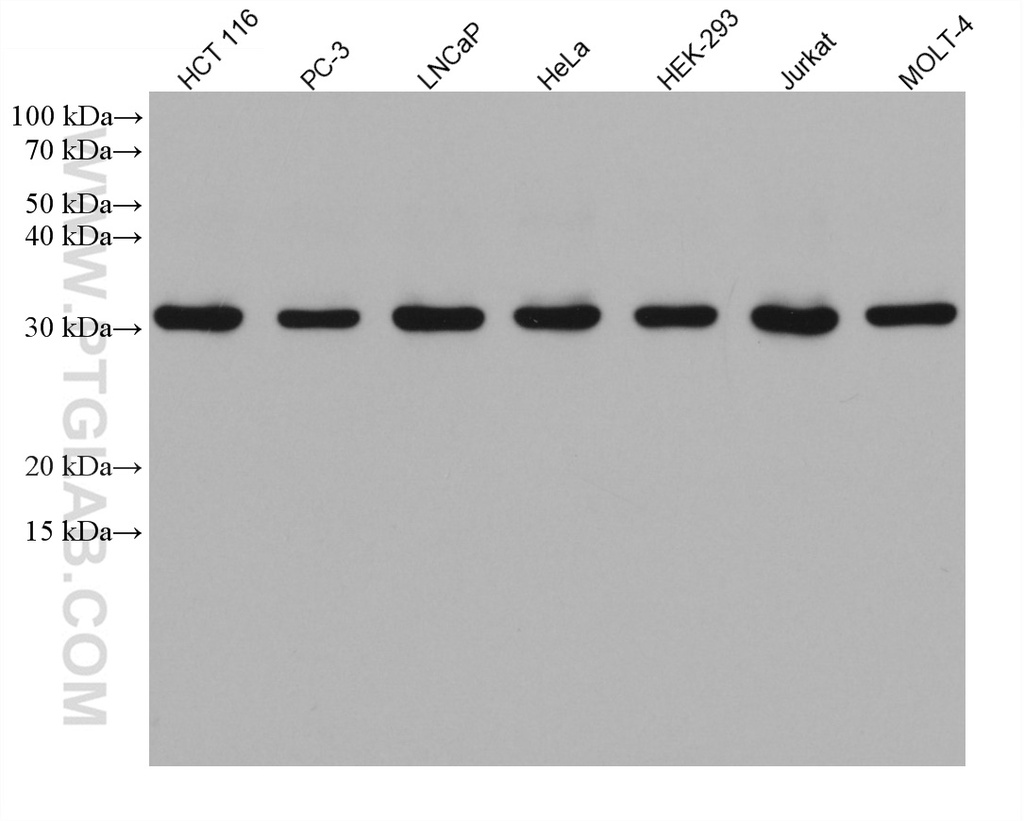 AES Monoclonal antibody