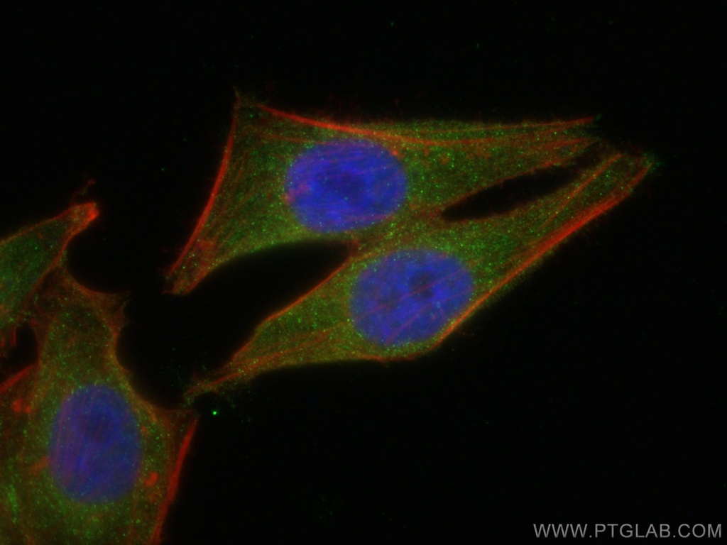 GEMIN8 Monoclonal antibody