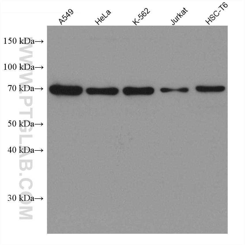 KBTBD2 Monoclonal antibody