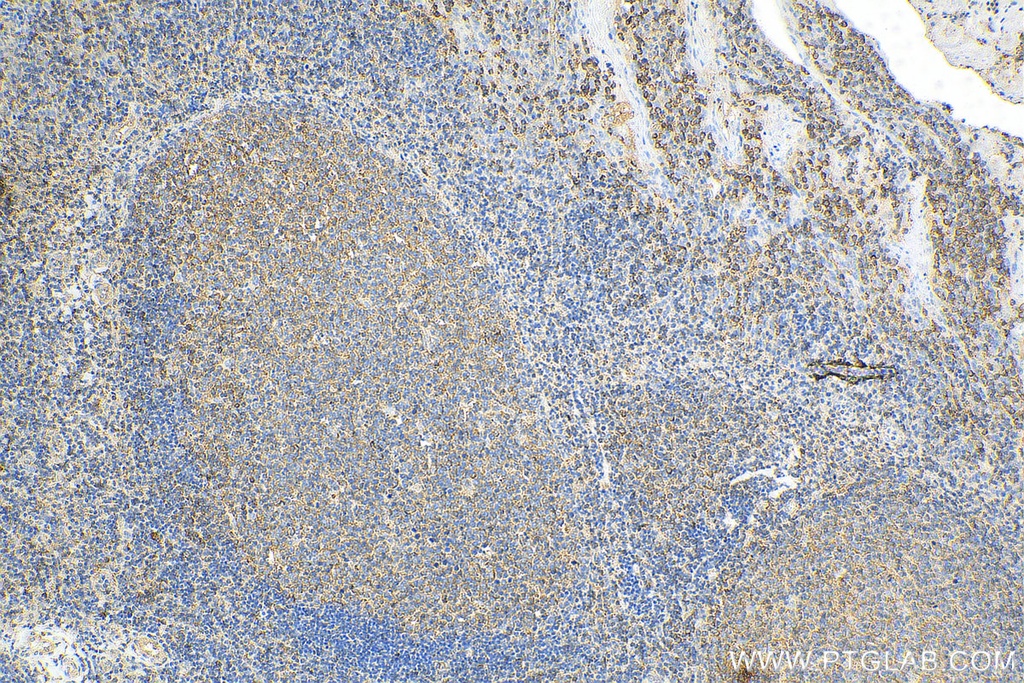 NeutraKine® IL-10 Monoclonal antibody