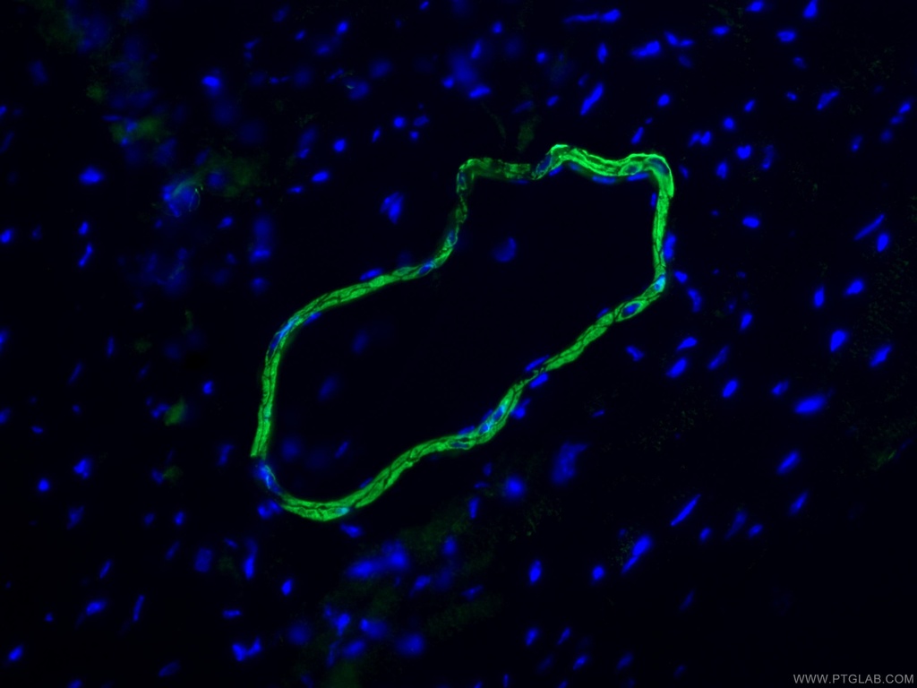 smooth muscle actin specific Recombinant antibody