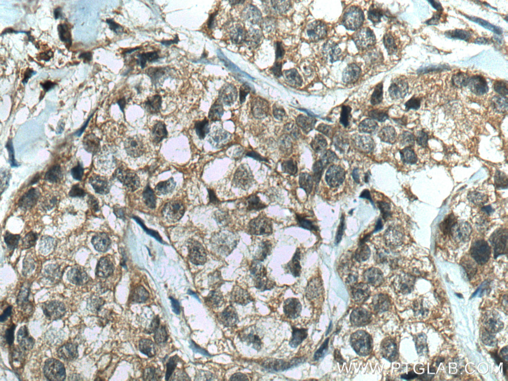 IkB Alpha Recombinant antibody