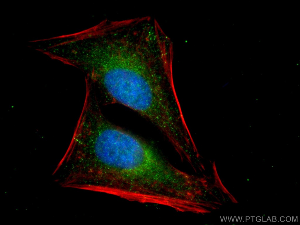 MAP2K3 Recombinant antibody