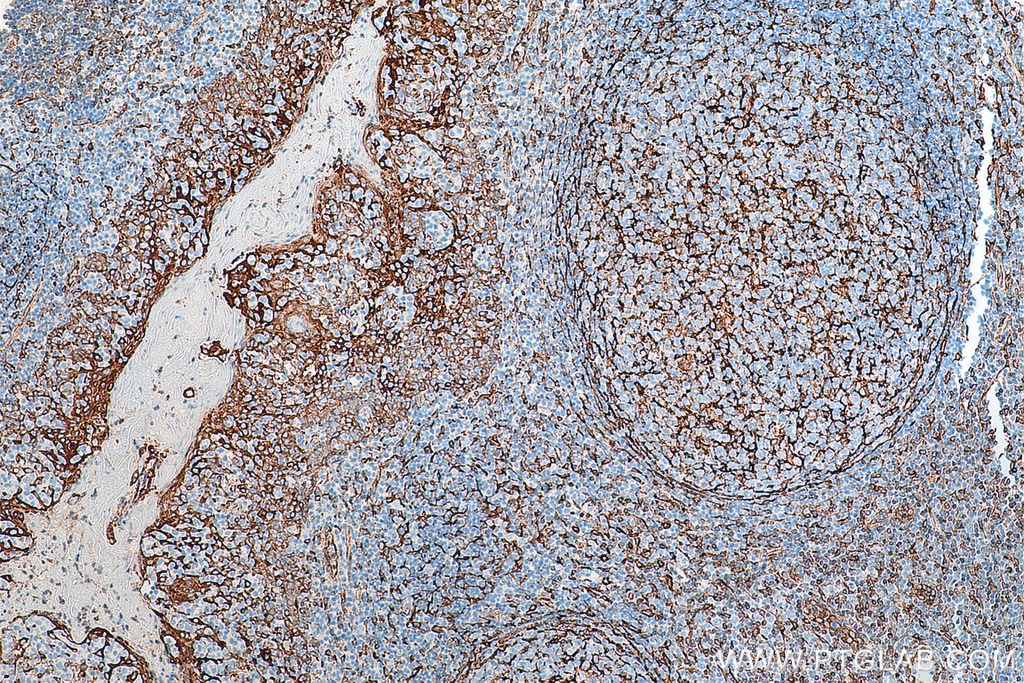 TMEM173/STING Recombinant antibody