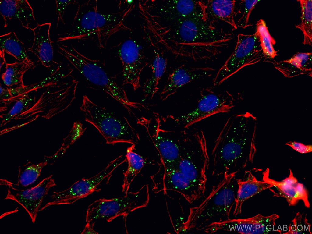 PDI Recombinant antibody