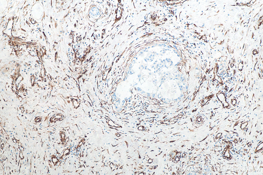 Vimentin Recombinant antibody