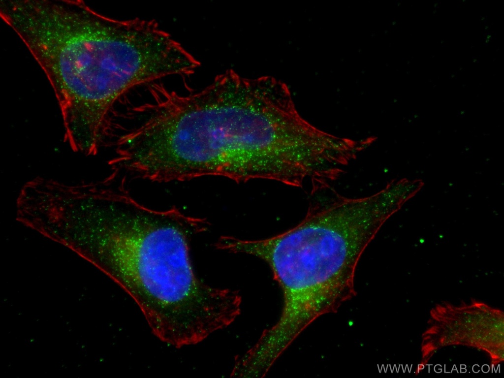 PEX14 Recombinant antibody