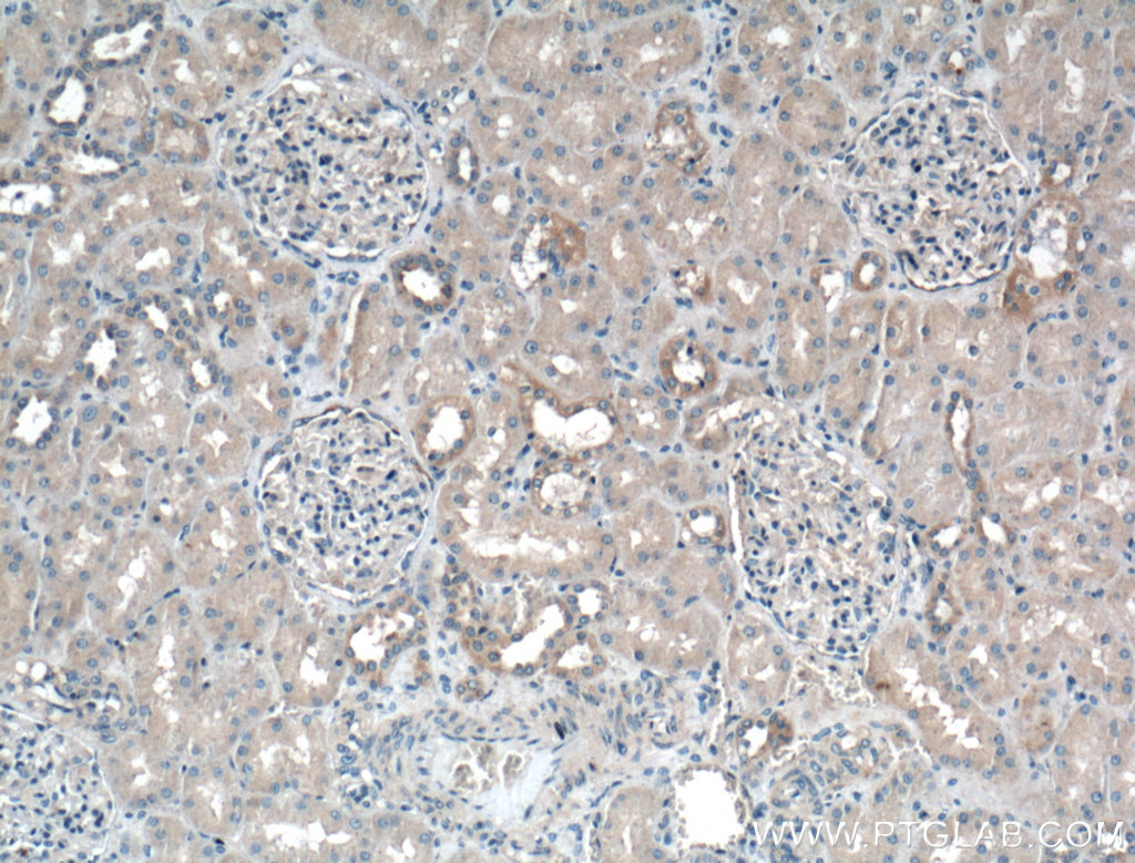 Biotin-conjugated Granulin Polyclonal antibody