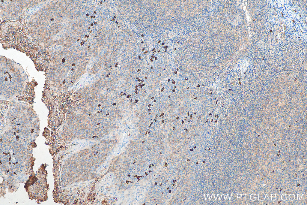 Biotin-conjugated Human IgA Monoclonal antibody
