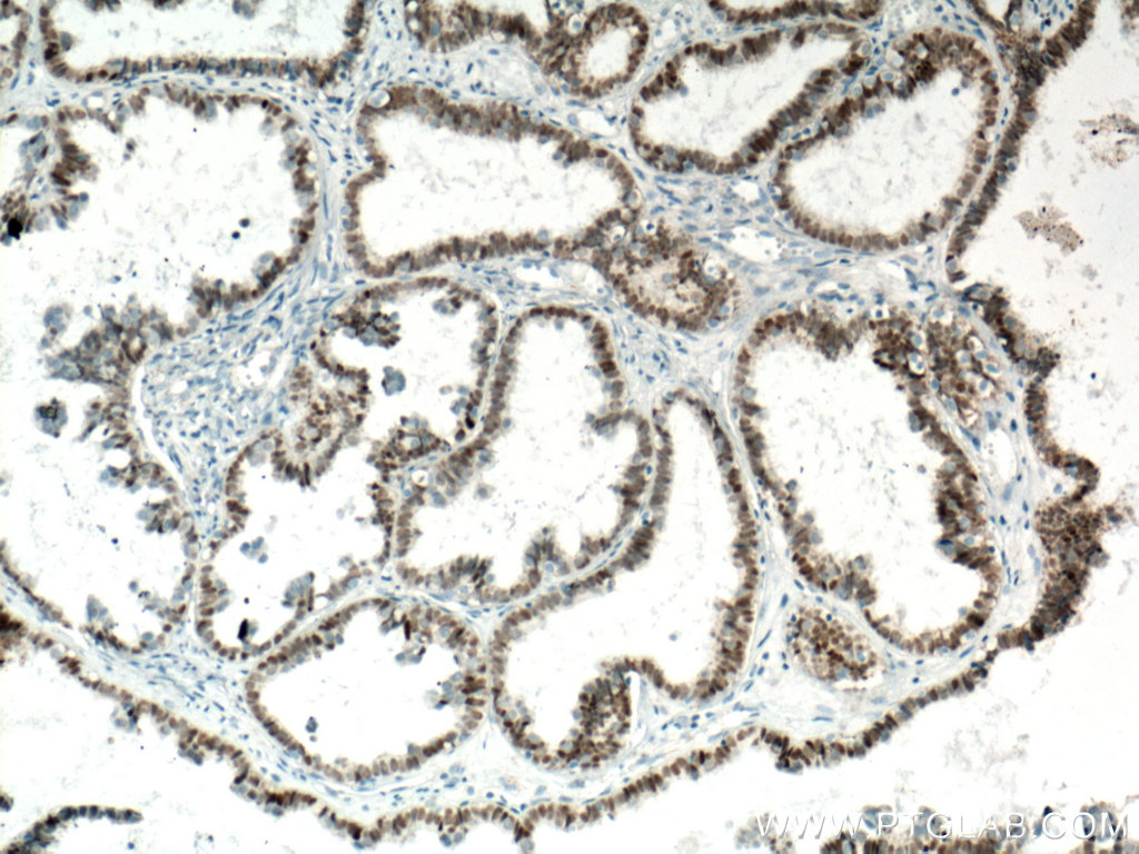 Biotin-conjugated PAX8 Monoclonal antibody