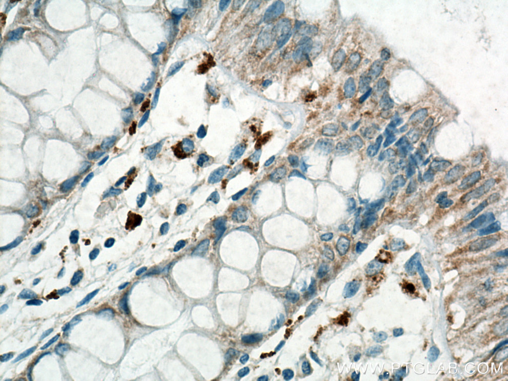 Biotin Anti-Human MICA/MICB (6D4)