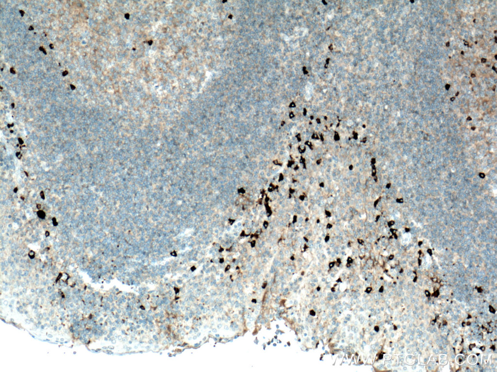 Biotin-conjugated Human IgG4 Monoclonal antibody