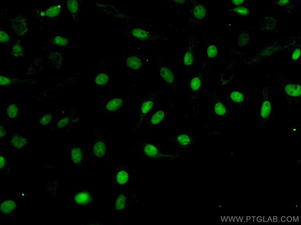 CoraLite®488-conjugated PAX8 Polyclonal antibody