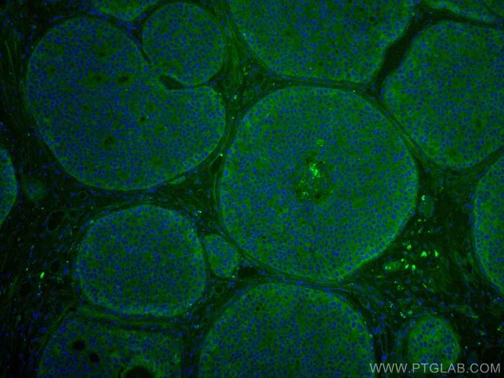CoraLite®488-conjugated KEAP1 Polyclonal antibody