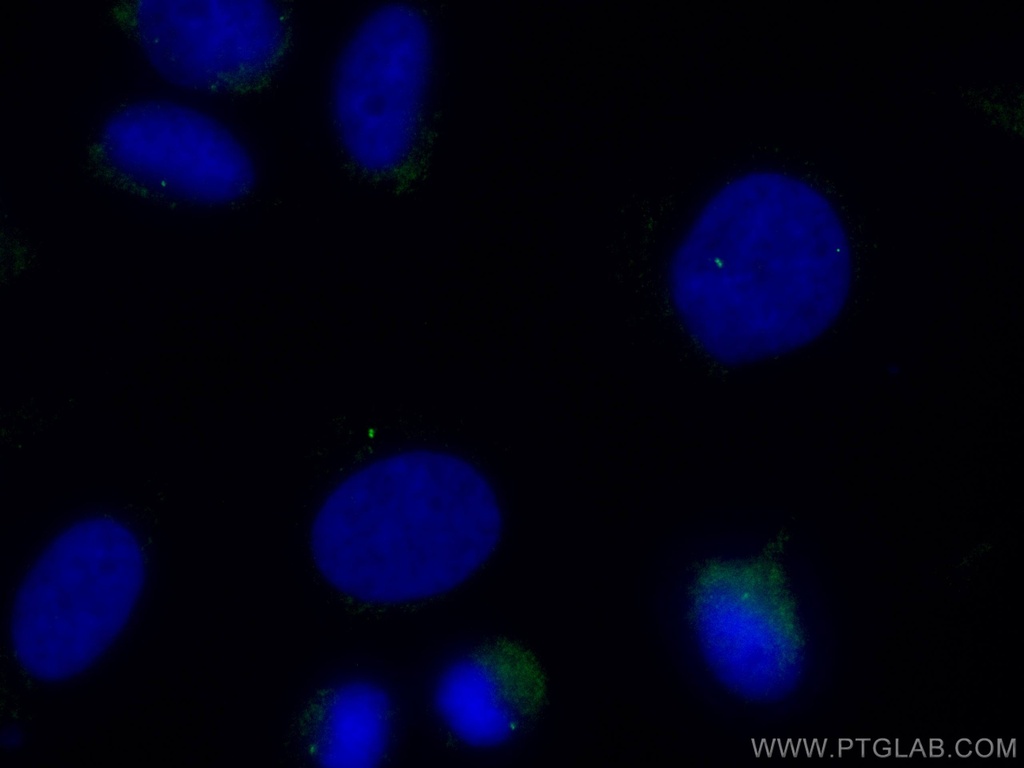 CoraLite®488-conjugated CENPJ Polyclonal antibody