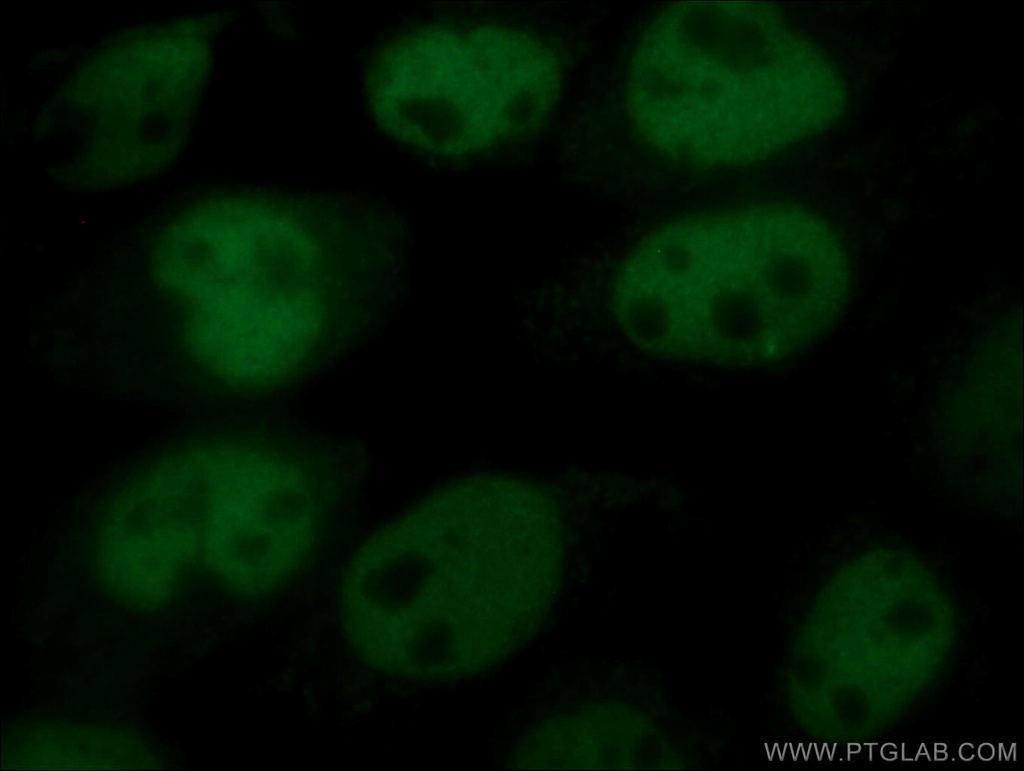 CoraLite®488-conjugated p63 Polyclonal antibody